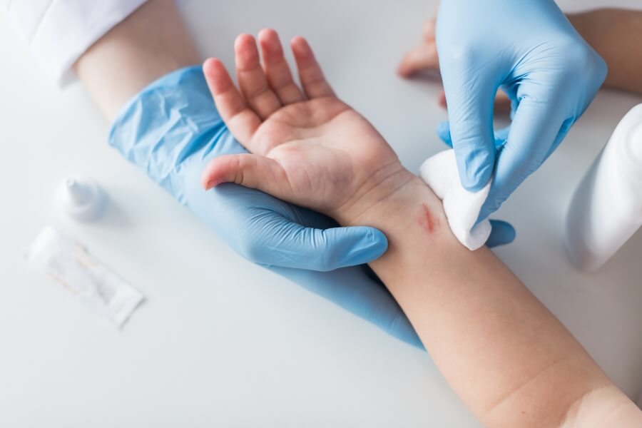 Ošetření odřeniny