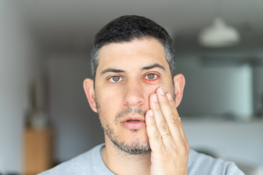 Dráždivý zánět spojivek